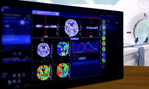 News - New PET CT scanner installed at Mary Lanning Healthcare